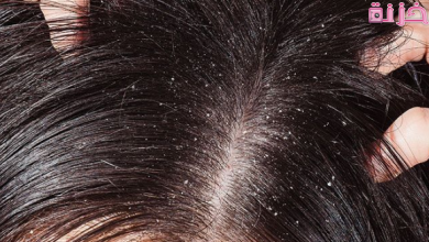 القمل في المنام