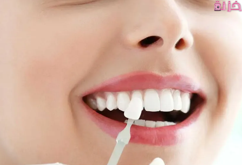 حلم سقوط الاسنان