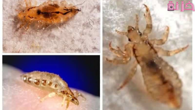 رؤية القمل في المنام للمتزوجة