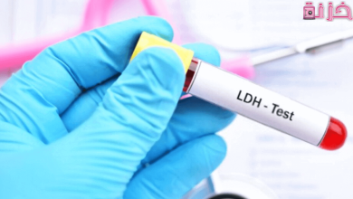 تحليل ldh