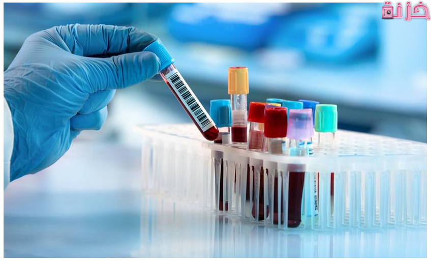 تحليل الحمل الرقمي