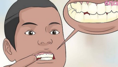 تنظيف الاسنان