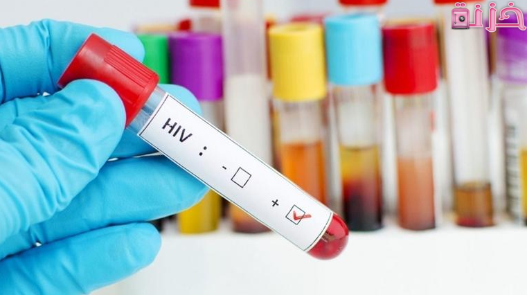 سعر تحليل الايدز في مصر