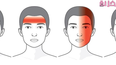 جميع اسباب الصداع المستمر لعدة ايام ومتى يكون خطير