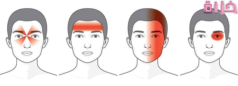 جميع اسباب الصداع المستمر لعدة ايام ومتى يكون خطير
