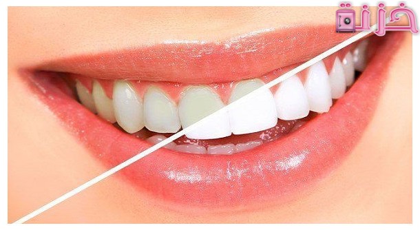 كيفية تبييض الاسنان
