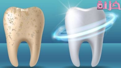 طرق اصلاح و تقوية مينا الاسنان