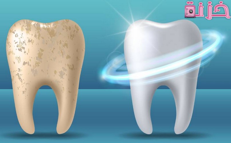طرق اصلاح و تقوية مينا الاسنان