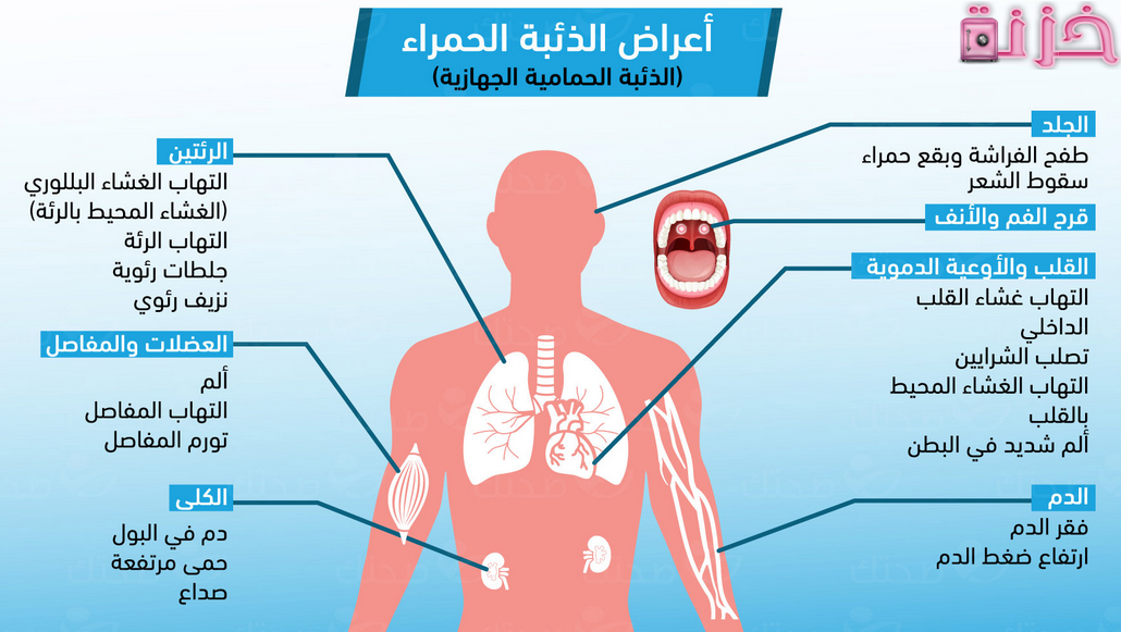 هل الذئبه الحمراء نوع من السرطان