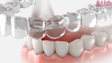 سعر تقويم Invisalign فى السعودية